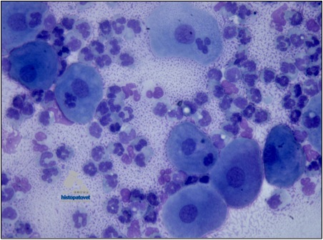 En inflamatorias no infecciosas. Vea grandes cantidades de polimorfos, junto a células grande epiteliales.